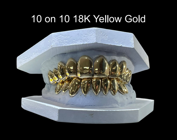 10 On 10 18K Yellow Gold Grillz